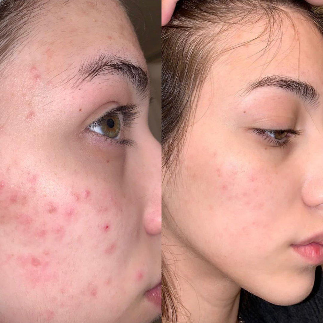 fitish daily face cleanser dry skin skin dry skin skin for dry skin dry skin dry skin a dry skin dry skin skin dry skin and dry skin dry skin that is dry xerosis skin scaly skin skin type flaky skin ashy skin best beauty shop oily face mature skin rough skin skin mature dry patches chapped skin before and after skincare beauty & beauty before after skincare an skin beauty type beauty beauty type