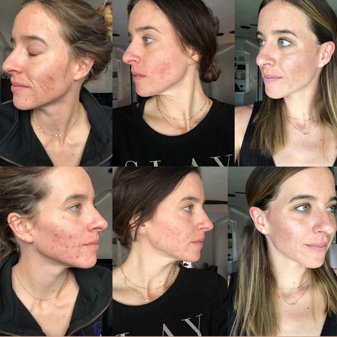 fitish tone down spray dry skin skin dry skin skin for dry skin dry skin dry skin a dry skin dry skin skin dry skin and dry skin dry skin that is dry xerosis skin scaly skin skin type flaky skin ashy skin best beauty shop oily face mature skin rough skin skin mature dry patches chapped skin before and after skincare beauty & beauty before after skincare an skin beauty type beauty beauty type