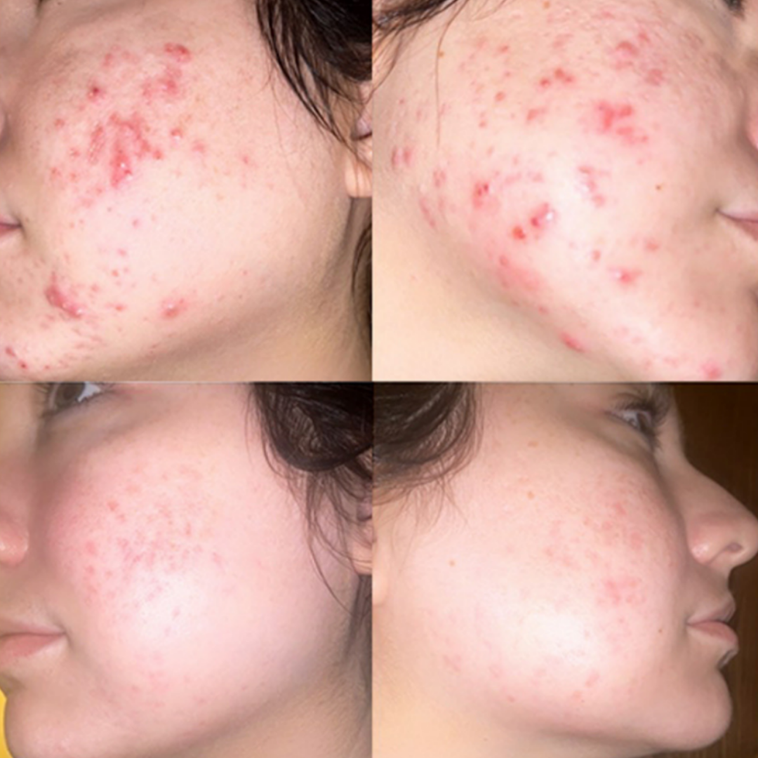 fitish daily moisturizer dry skin skin dry skin skin for dry skin dry skin dry skin a dry skin dry skin skin dry skin and dry skin dry skin that is dry xerosis skin scaly skin skin type flaky skin ashy skin best beauty shop oily face mature skin rough skin skin mature dry patches chapped skin before and after skincare beauty & beauty before after skincare an skin beauty type beauty beauty type