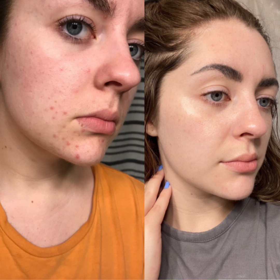 fitish daily moisturizer dry skin skin dry skin skin for dry skin dry skin dry skin a dry skin dry skin skin dry skin and dry skin dry skin that is dry xerosis skin scaly skin skin type flaky skin ashy skin best beauty shop oily face mature skin rough skin skin mature dry patches chapped skin before and after skincare beauty & beauty before after skincare an skin beauty type beauty beauty type