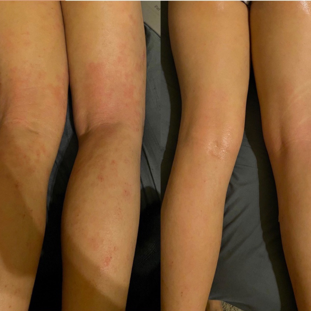 fitish tone down spray dry skin skin dry skin skin for dry skin dry skin dry skin a dry skin dry skin skin dry skin and dry skin dry skin that is dry xerosis skin scaly skin skin type flaky skin ashy skin best beauty shop oily face mature skin rough skin skin mature dry patches chapped skin before and after skincare beauty & beauty before after skincare an skin beauty type beauty beauty type