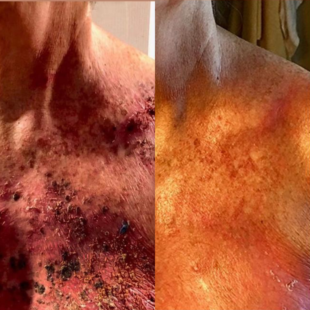 fitish tone down spray dry skin skin dry skin skin for dry skin dry skin dry skin a dry skin dry skin skin dry skin and dry skin dry skin that is dry xerosis skin scaly skin skin type flaky skin ashy skin best beauty shop oily face mature skin rough skin skin mature dry patches chapped skin before and after skincare beauty & beauty before after skincare an skin beauty type beauty beauty type