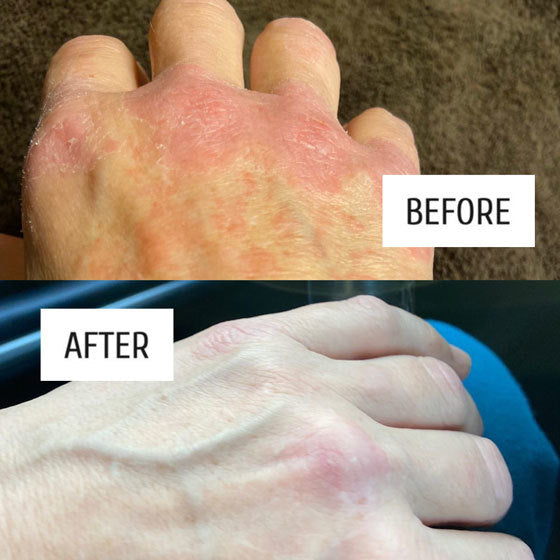 REVIEW: BEFORE AND AFTER