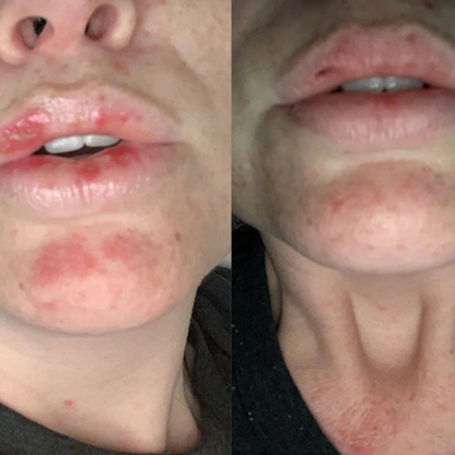 close up before and after using fitish cbd lip game